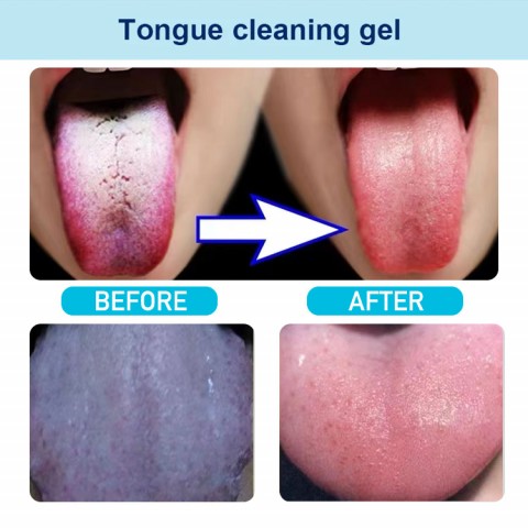 Tongue Cleaning Gel With Brush - Reduce Bad Breath, Healthy Oral Hygiene Brush -  For Adults and Kids